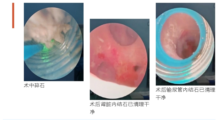 微信截图_20250219170807.png